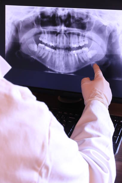 Best Broken or Cracked Tooth Emergency Dentist in Park City, UT