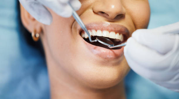 Best Emergency Dentist for Special Needs Patients in Park City, UT